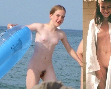 Bare Lake Days photos - Nudists relax beautifully—a sight to behold